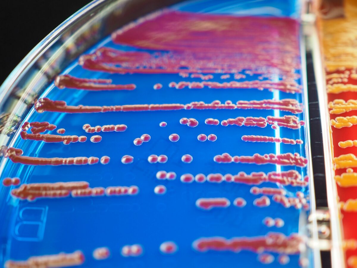 guide-to-agar-media-in-microbiology