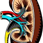 Severe cases of UTI can spread to the kidneys. 