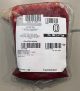 A unit of red blood cells collected from a local blood drive.