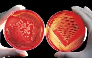 2 sheep blood agar plates which demonstrate bacterial growth with beta hemolysis. 