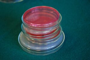 Assortment of various agar plates. 