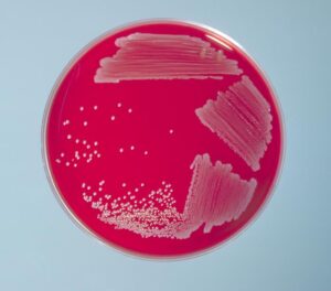 Material for gram staining is pulled from well isolated colonies found on an agar plate. 