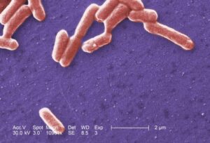 Gram stain of E.coli, seen as gram negative bacillus