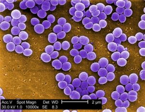 Gram stain of Staph Aureus seen as gram positive cocci in clusters