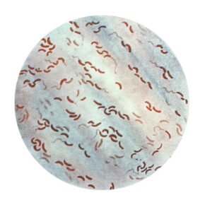 Gram stain of Vibrio species, seen as comma shaped gram negative bacilli