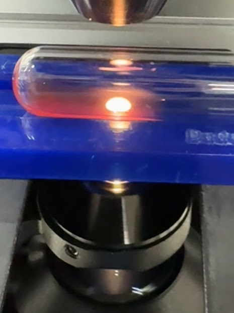 The Rosette Test is one of the 3 primary methods of detecting fetomaternal bleeds.