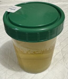 A "Clean-Catch" Urine Specimen