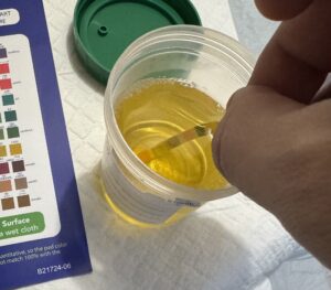 Urine dipsticks are commonly used to test for UTI at-home. 