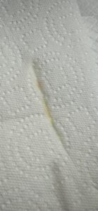 The multiple colors seen on the paper towel show excess urine that has been left behind. 